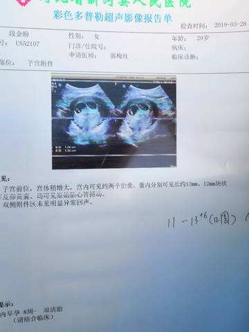 journal_insert_pic_1207776822