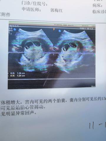 journal_insert_pic_1207776829