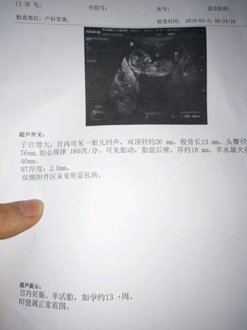 journal_insert_pic_1207604883