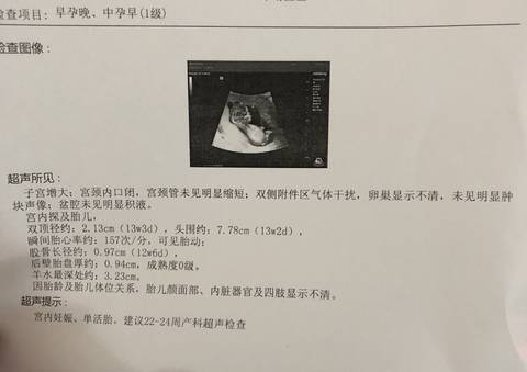 journal_insert_pic_1214783266