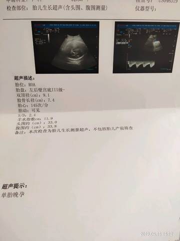 journal_insert_pic_1216403134