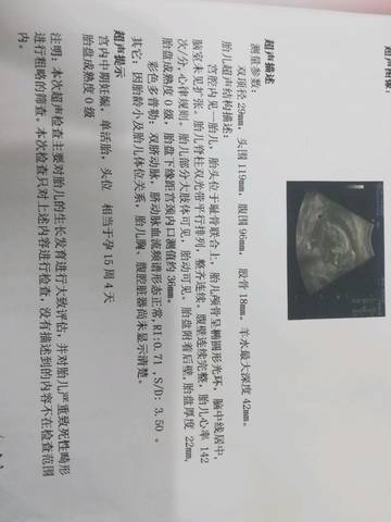 journal_insert_pic_1217166573