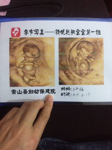 journal_insert_pic_1218545651