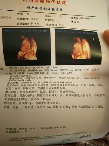 journal_insert_pic_1219237395