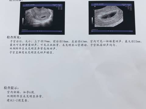 journal_insert_pic_1220019185