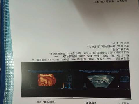 journal_insert_pic_1220363902
