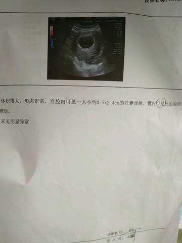 journal_insert_pic_1222052311