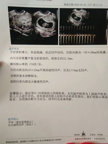 journal_insert_pic_1222596251