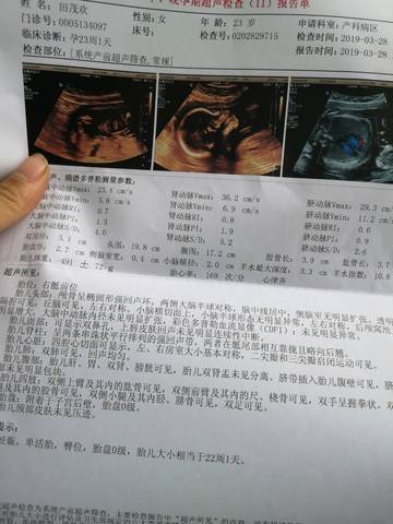 journal_insert_pic_1222533091