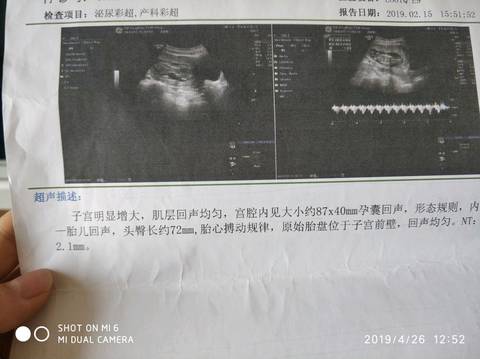 journal_insert_pic_1223911350