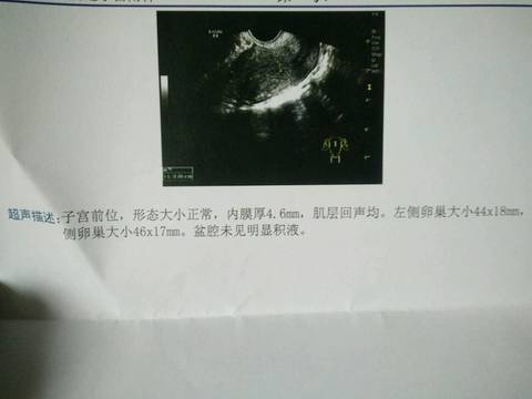 journal_insert_pic_1223971316
