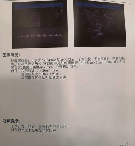 journal_insert_pic_1230073866