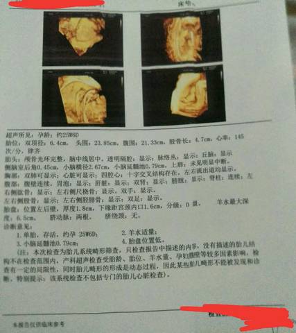 journal_insert_pic_1230769139
