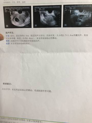 journal_insert_pic_1230730833