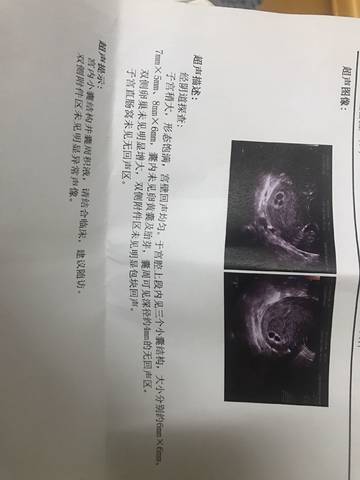 journal_insert_pic_1231319422