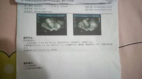 journal_insert_pic_1231228353