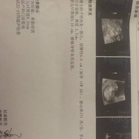 journal_insert_pic_1230963267