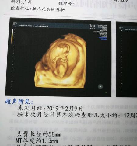 journal_insert_pic_1231002859