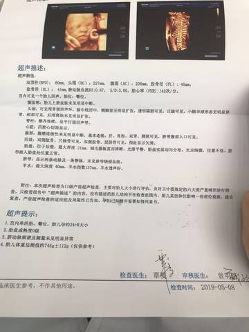 journal_insert_pic_1232302222