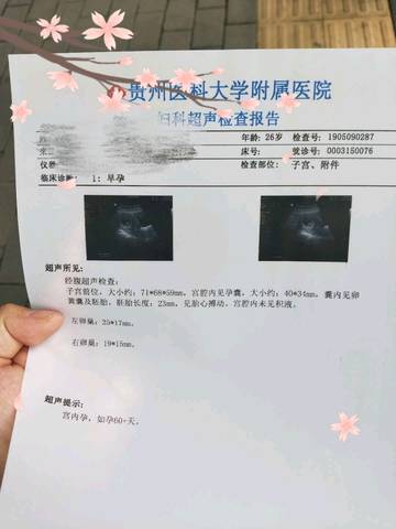 journal_insert_pic_1235559722
