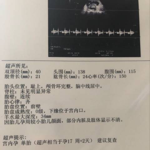 journal_insert_pic_1236223289