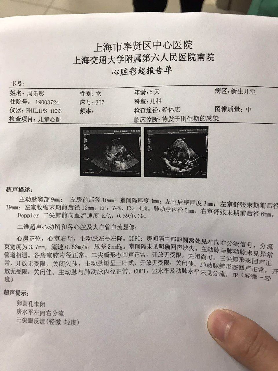 宝宝卵圆孔未闭