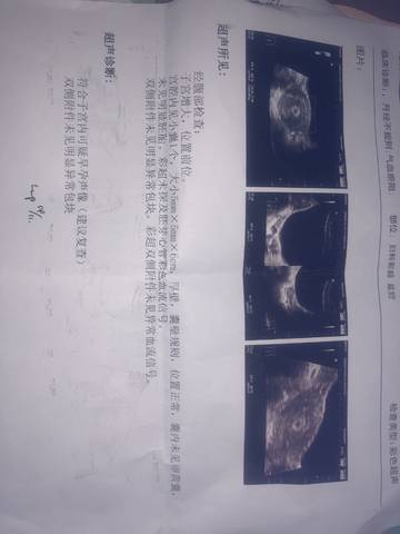 journal_insert_pic_1236433437