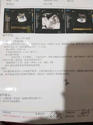 journal_insert_pic_1237980686