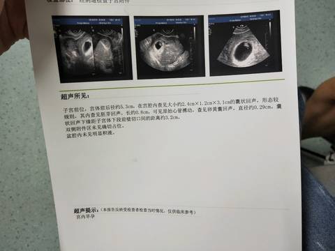 journal_insert_pic_1237809303