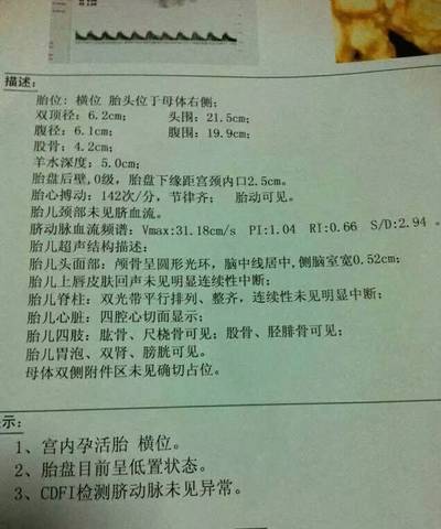 journal_insert_pic_1237748994