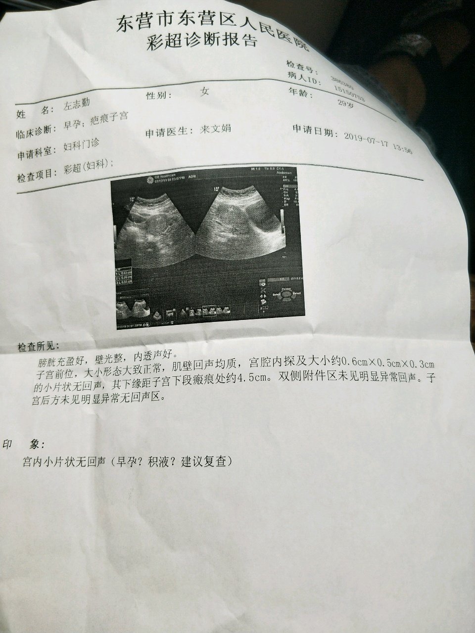 帮忙看一下