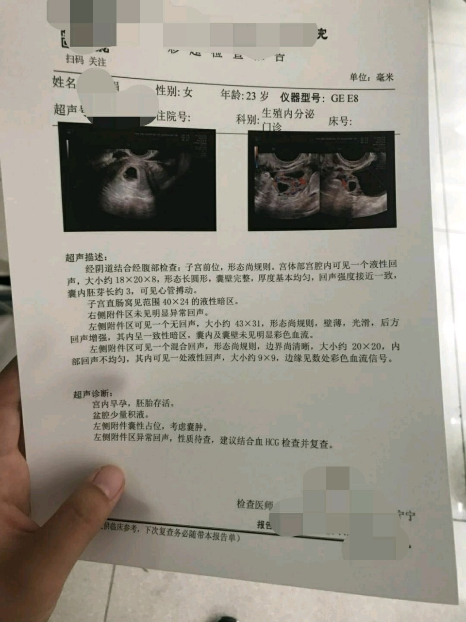 希望过来的宝妈能帮我看一下报告单