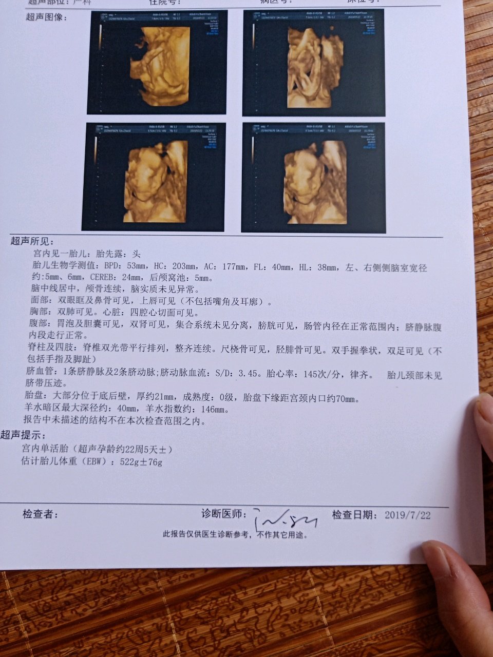今天刚去检查的