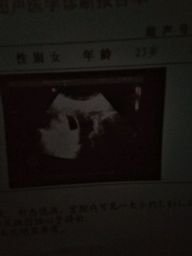 hallo能看出什么来么