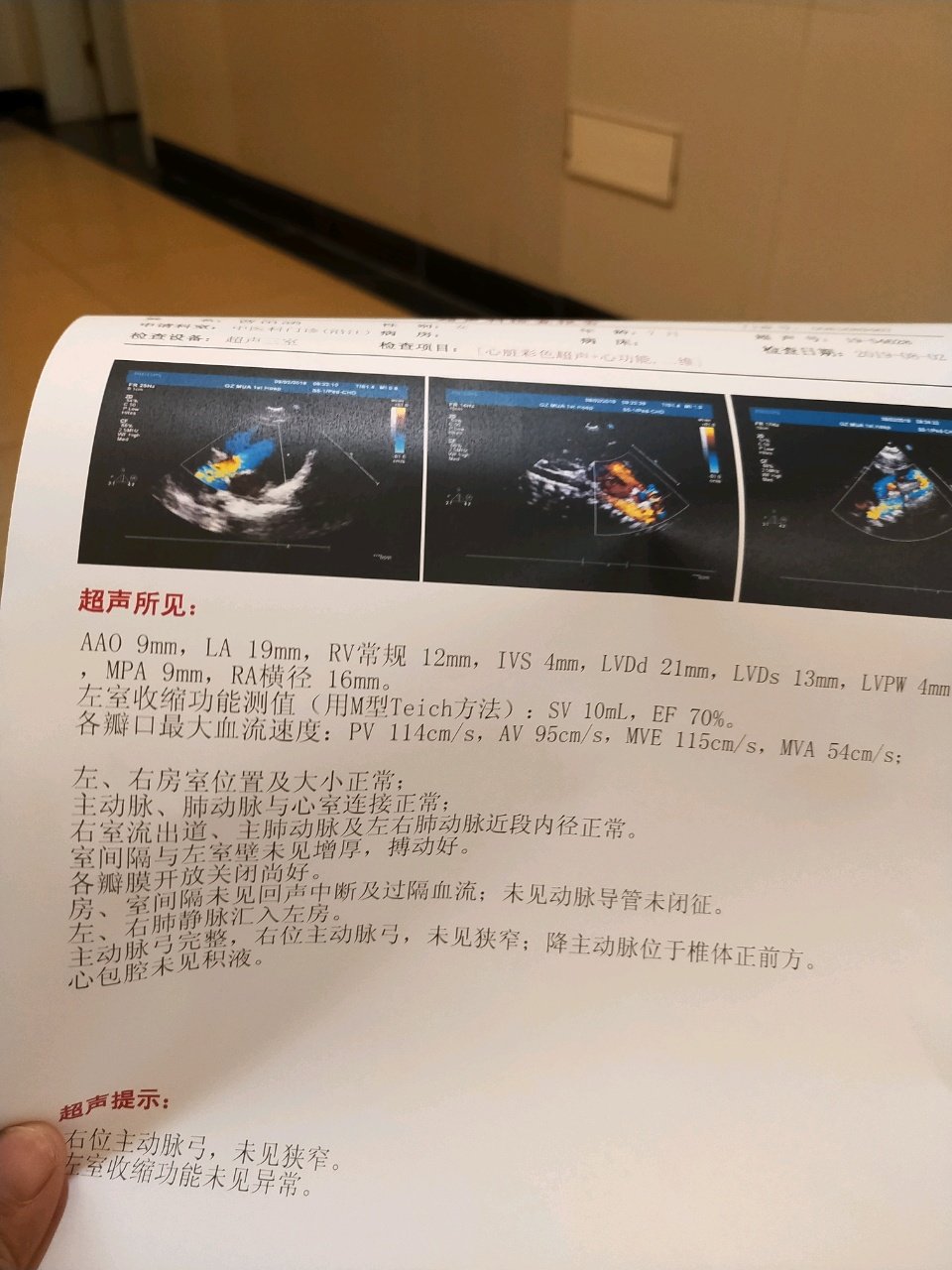 宝宝6个月右位主动脉弓，求解。