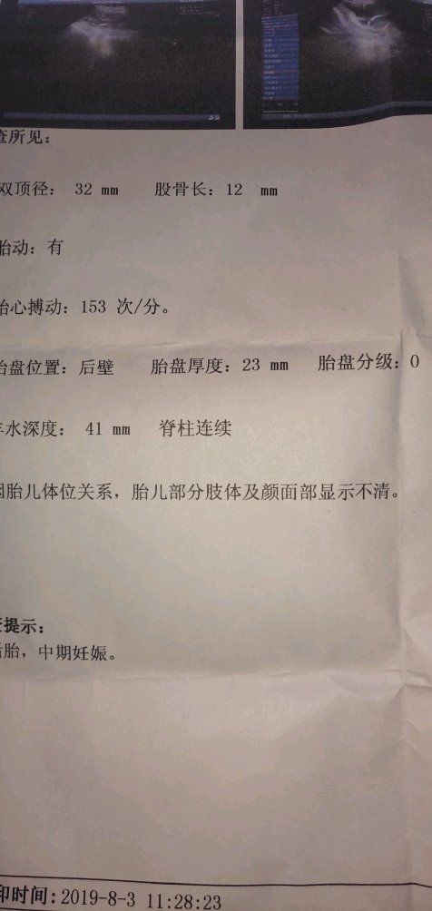 【新手报到】怀孕14+4天，胎儿双顶项32mm股骨长12mm,这正常吗？