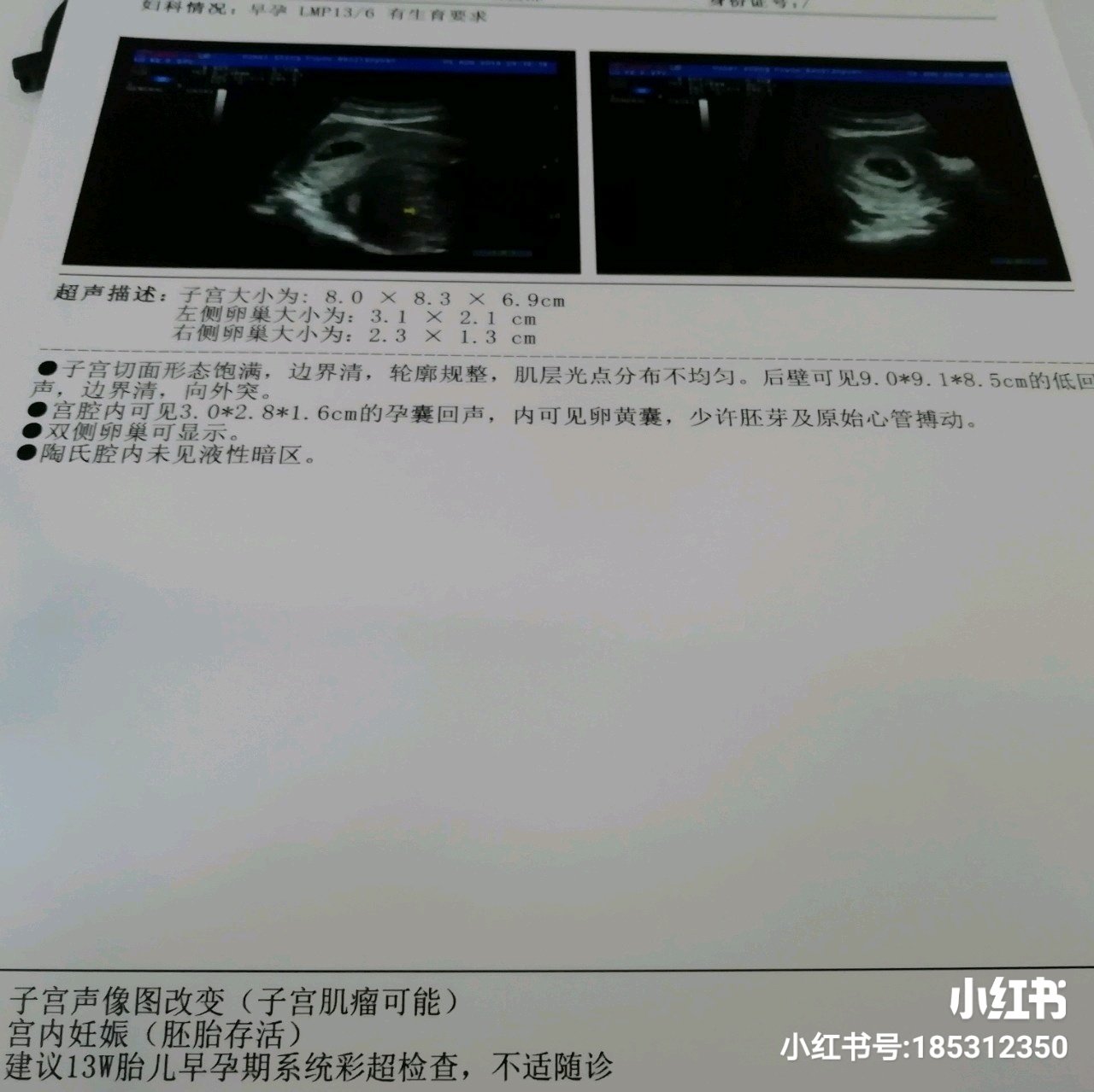 【新手报到】怀孕中被疑难杂症困扰的宝妈