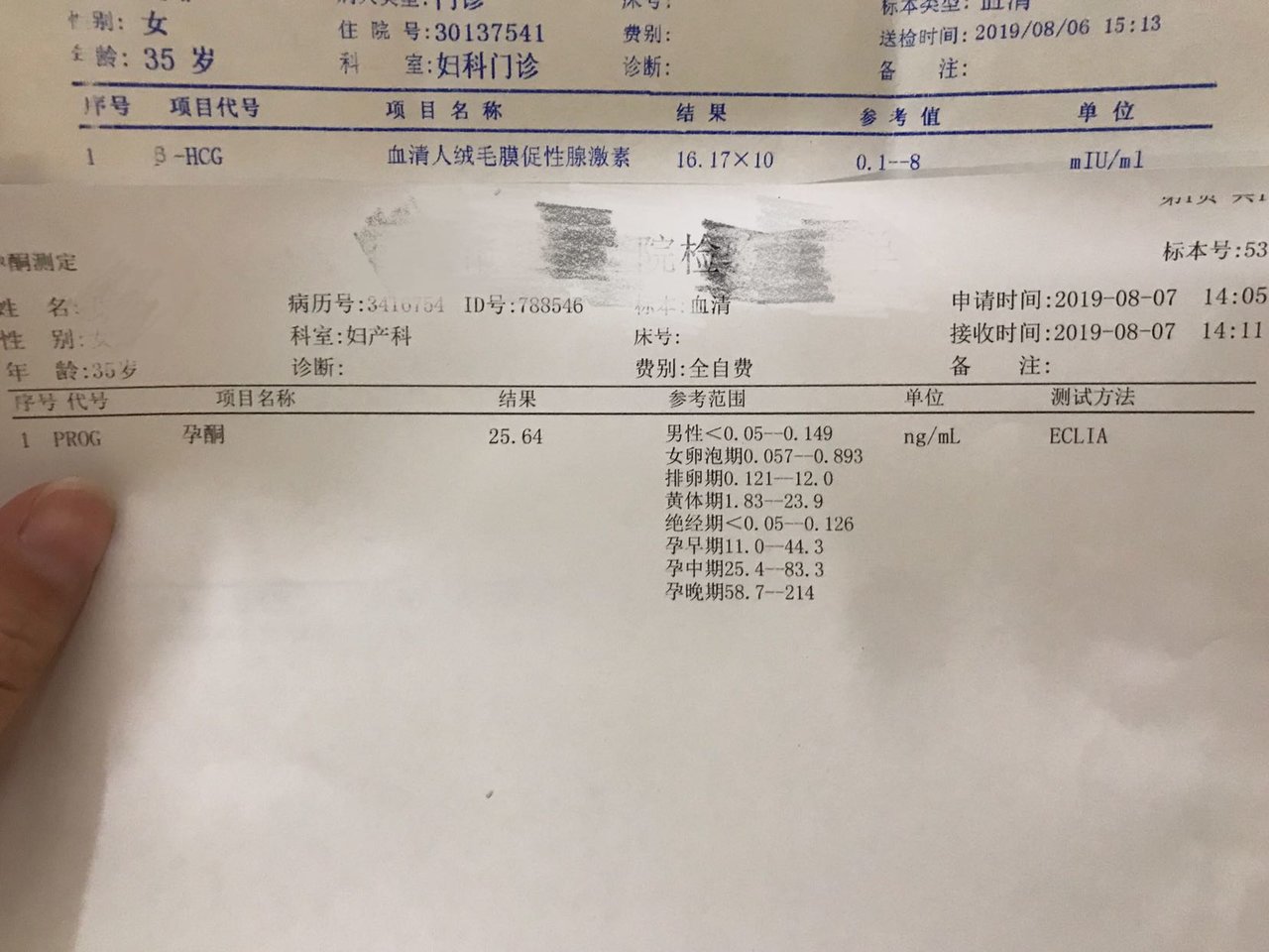 记录1
