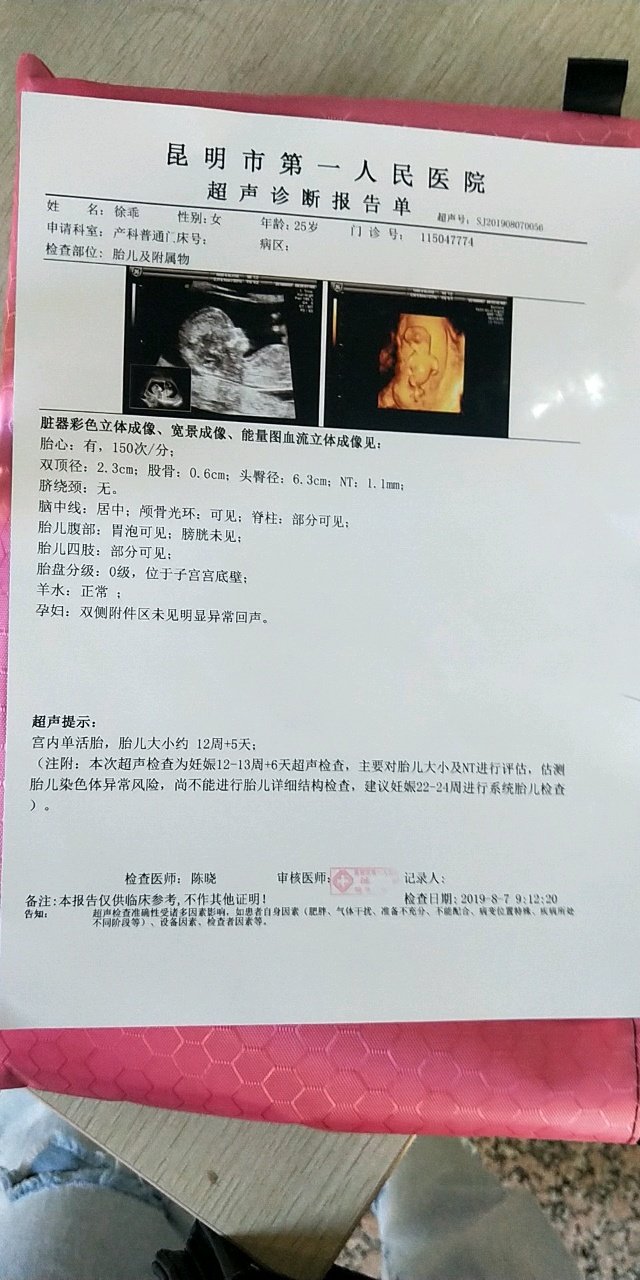 怀孕三个月一次都没有吐过好吗