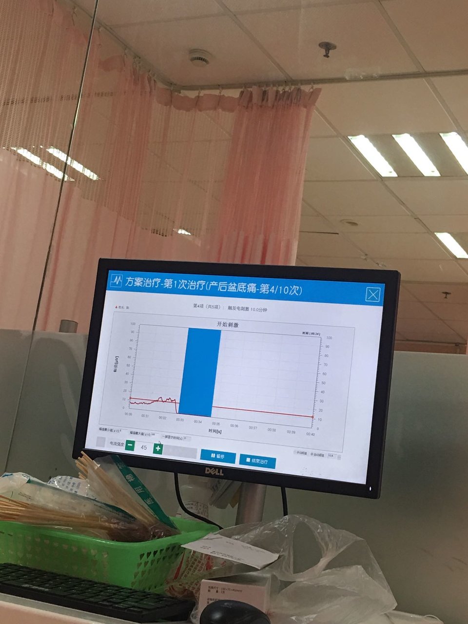 产后恢复