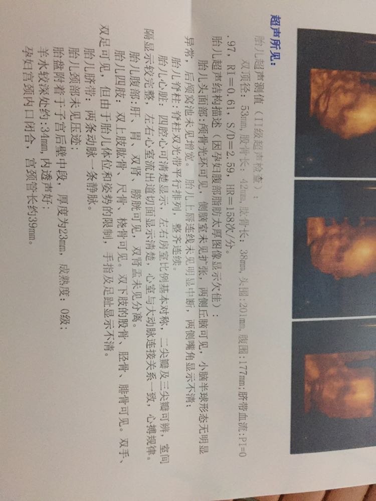 新手报到