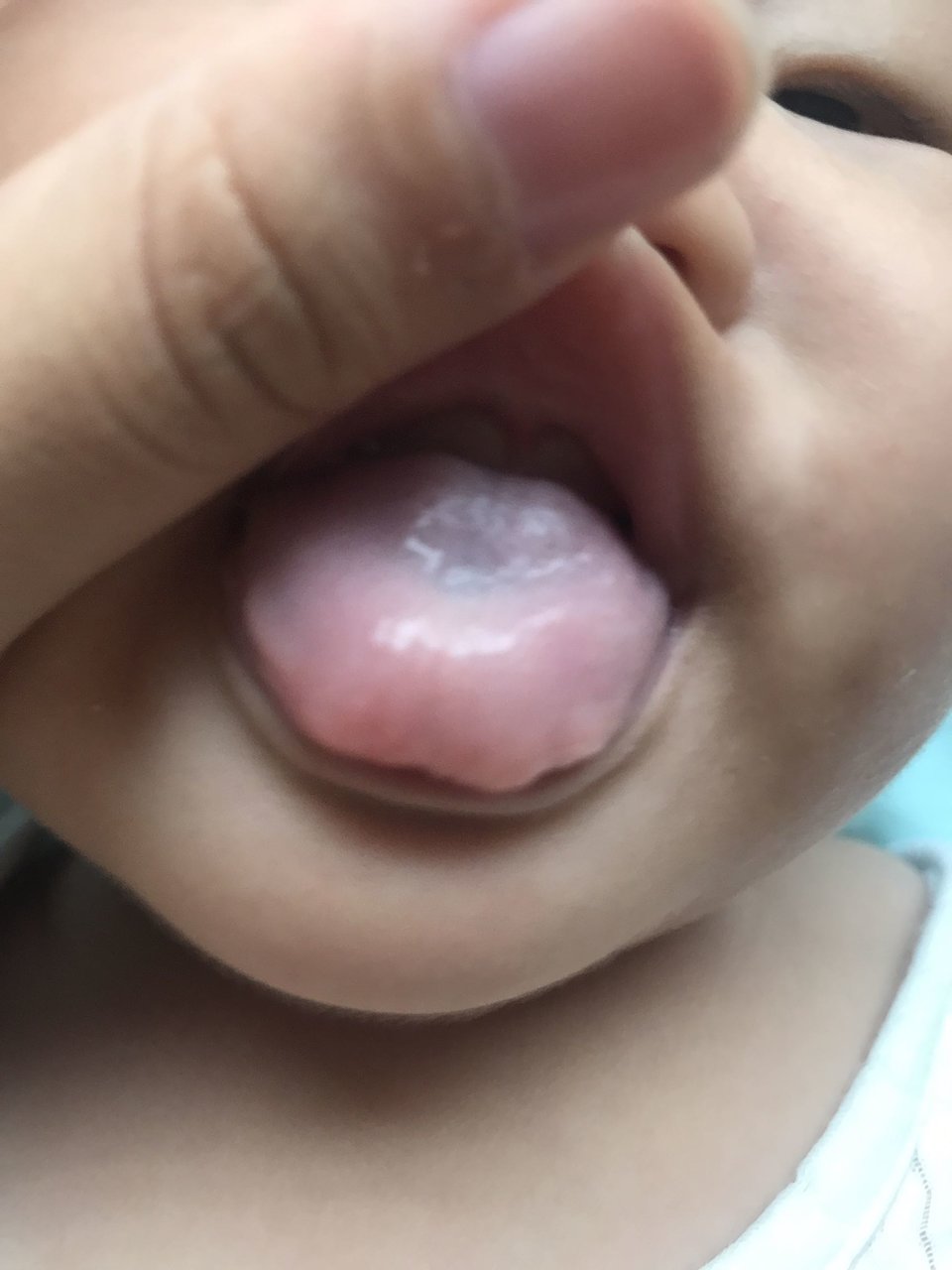 宝宝舌头发白是怎么回事啊？如图 她不光是舌苔白