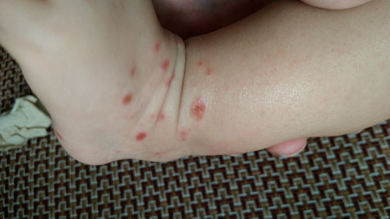 急急  宝妈们，帮我看看