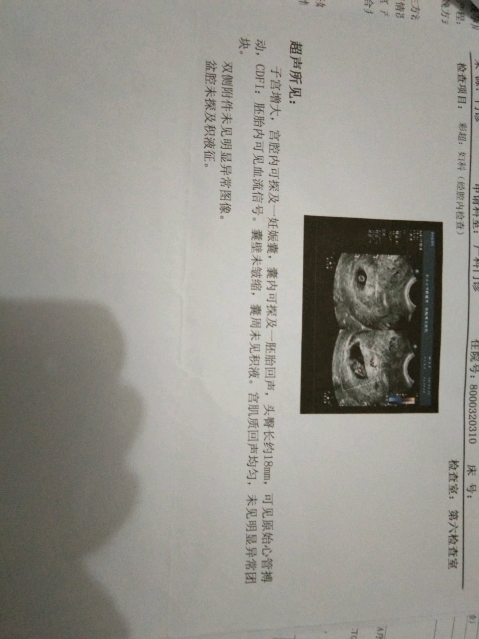 有会看NT单的宝妈吗