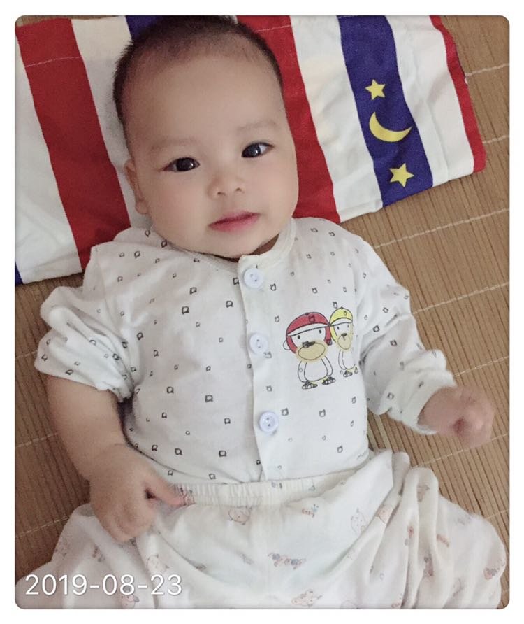 怎么双眼皮说没就没了😔