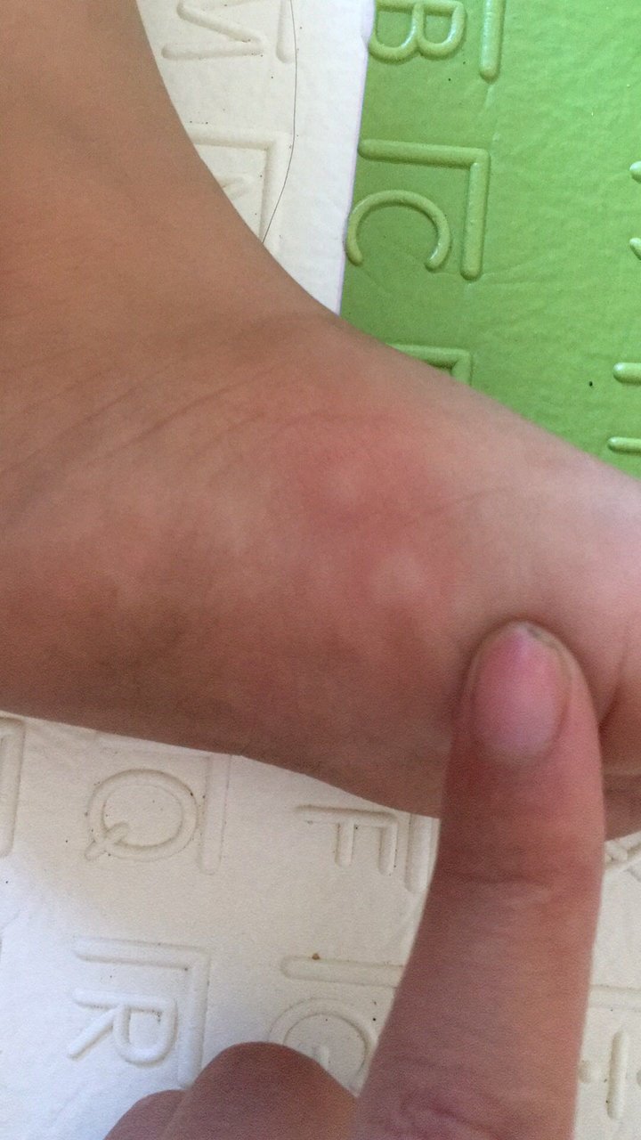 这是什么啊！反反复复一个多月了，