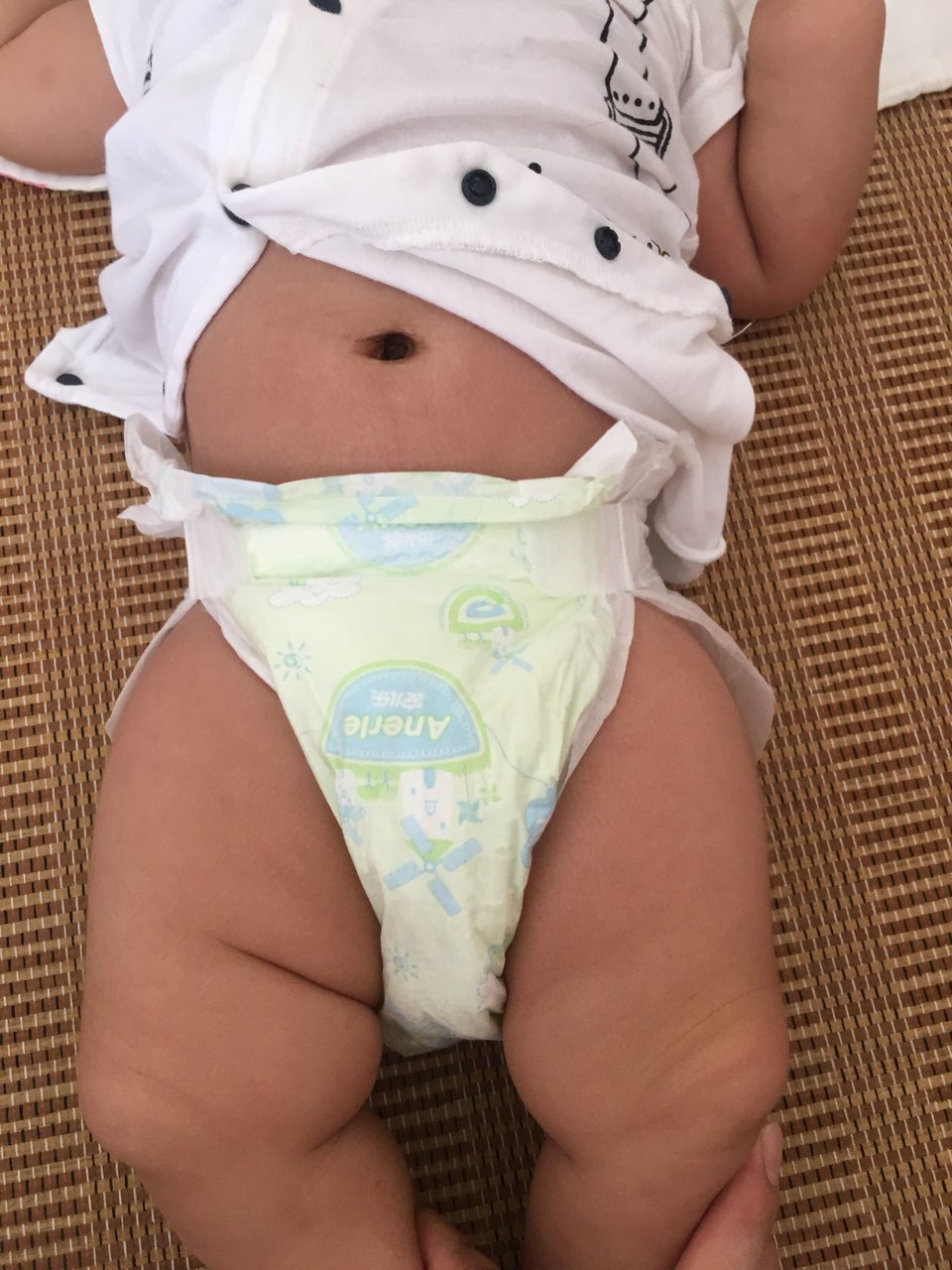 宝宝四个多月了，大腿右边比左边大腿肉多，什么原因正常吗？