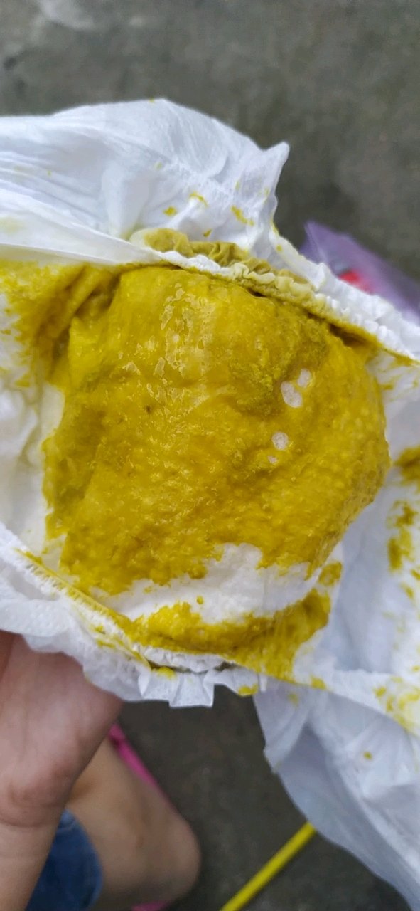 宝妈们，我家宝宝这两天拉便便这样怎么回事 
  
 
