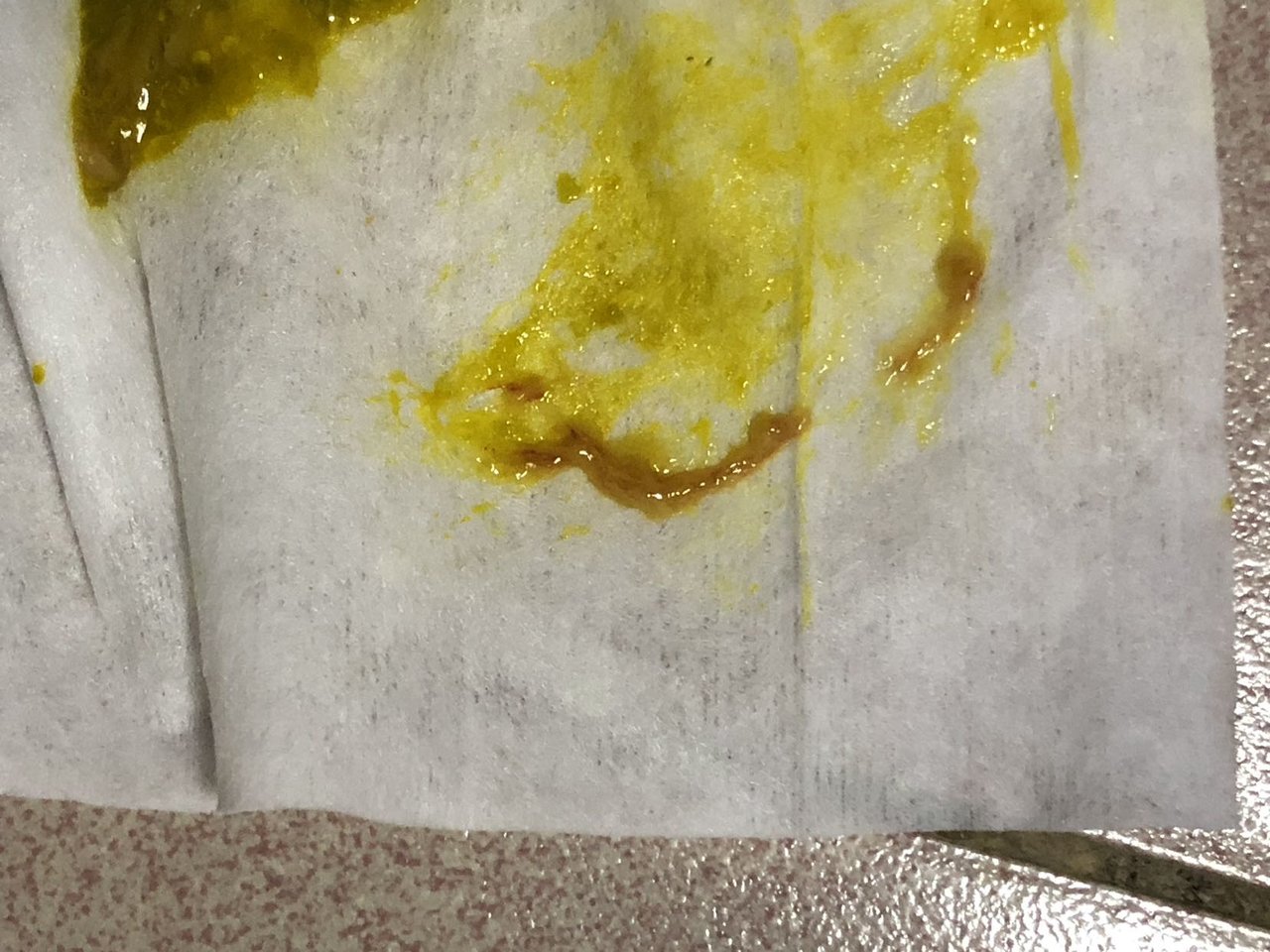 宝宝7个月大便有条长长的血丝像虫子  有图！！！