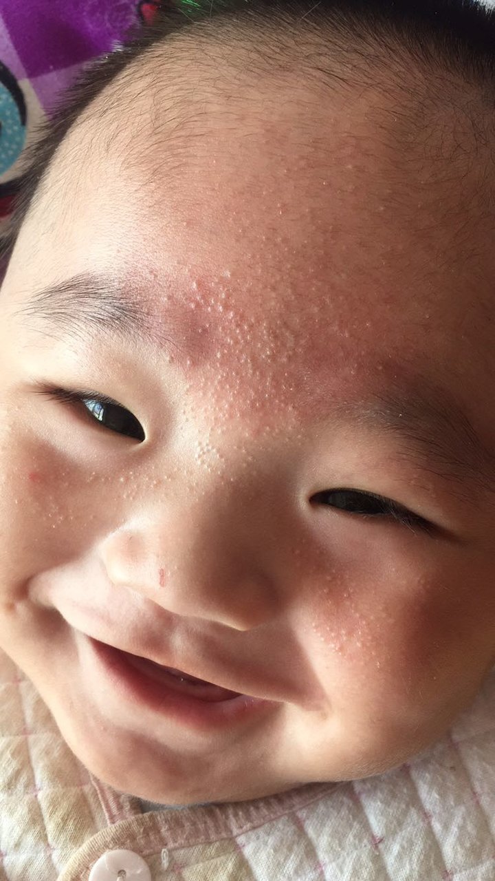 我快疯了